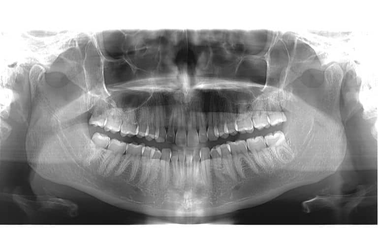 Cone Beam Ct Scan: A New Era for Diagnosis & Treatment | Facial Imaging ...